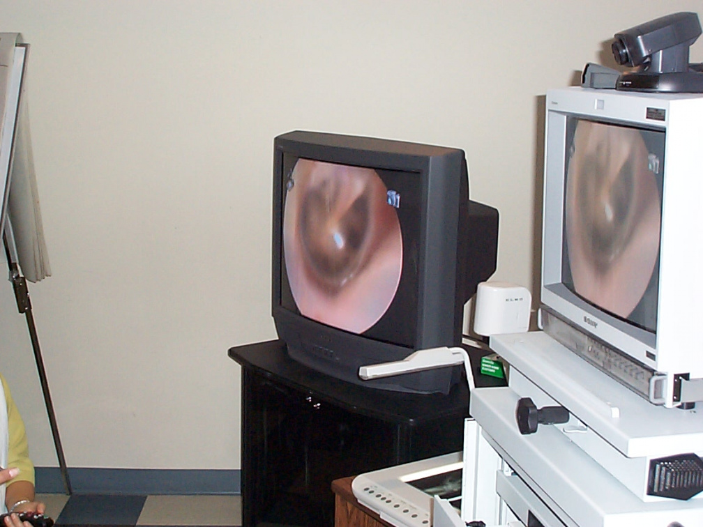 Using Telehealth to show someone's eardrum.